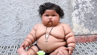 World's Fattest Baby: Body Bizarre